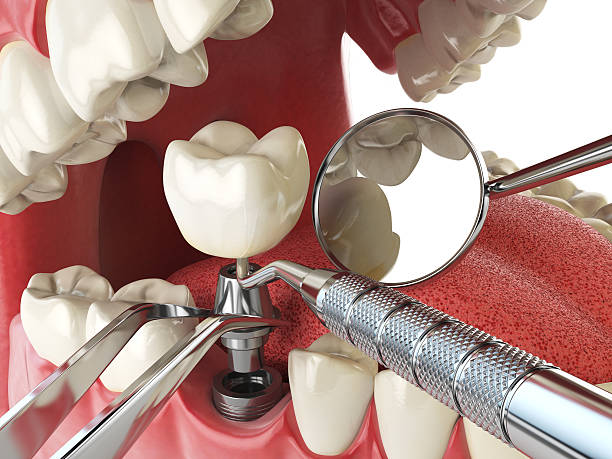 Best Tooth Pain Emergency Relief  in Utica, NE